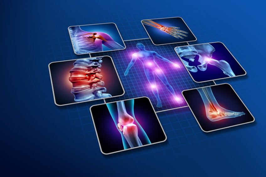 Fibromyalgia