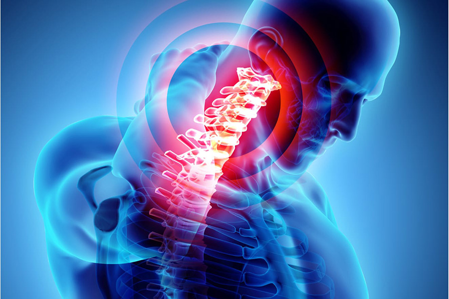 Kyphosis causes, symptoms and treatment BackPainSources