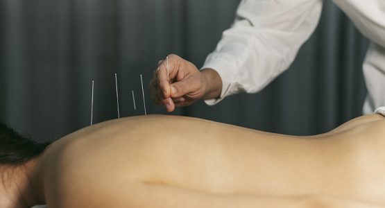 Acupuncture for the treatment of back pain