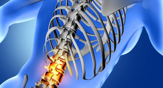 Treatment for Spondylolisthesis