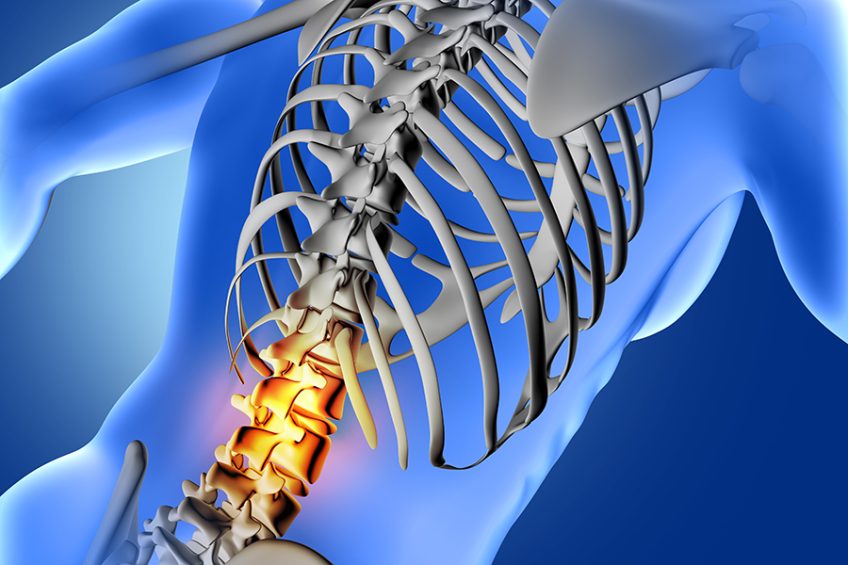 Treatment for Spondylolisthesis