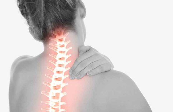 Treatment for Spondylosis (Osteoarthritis)