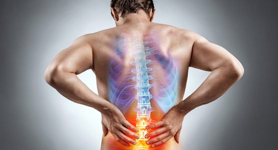 Low back pain caused by irritable bowel syndrome