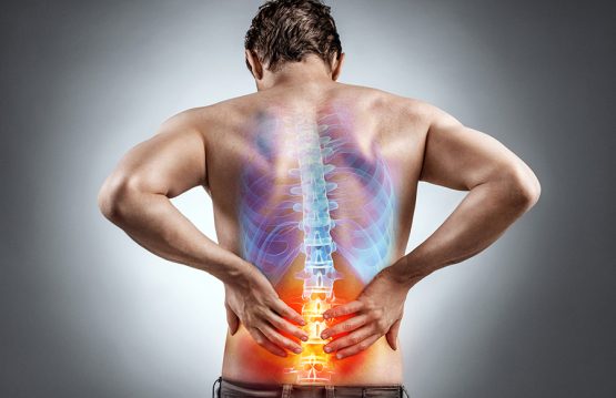 Low back pain caused by irritable bowel syndrome