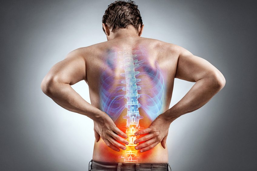 Low back pain caused by irritable bowel syndrome