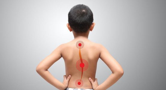Child Scoliosis: causes and symptoms