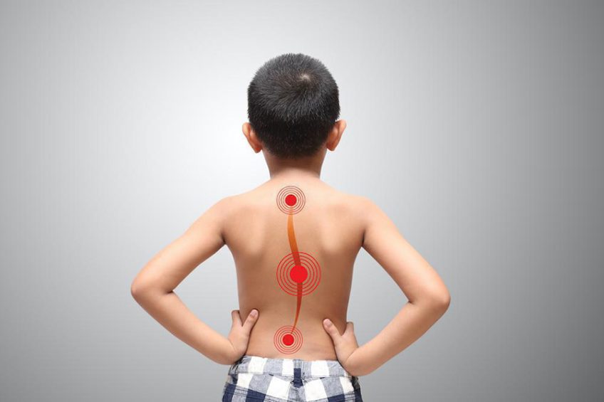 Child Scoliosis: causes and symptoms