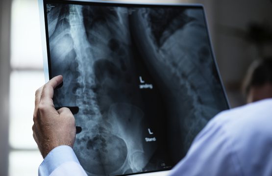 Conditions that affect the spine in the long term