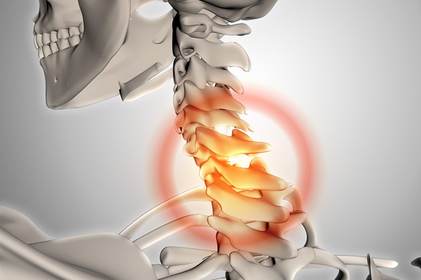 Torticollis what is it and how can we treat it