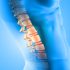 Spinal Infections