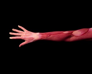 Disc protrusion symptoms, diagnosis and treatment