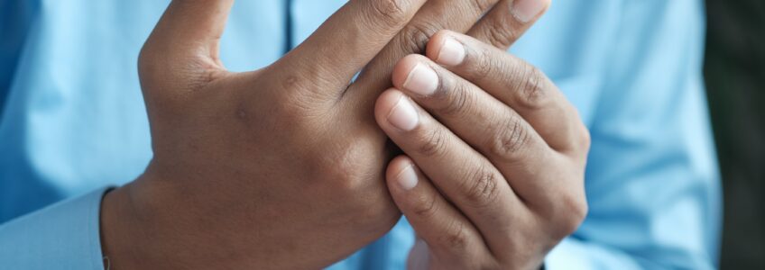 Rheumatoid arthritis - 10 things you should know